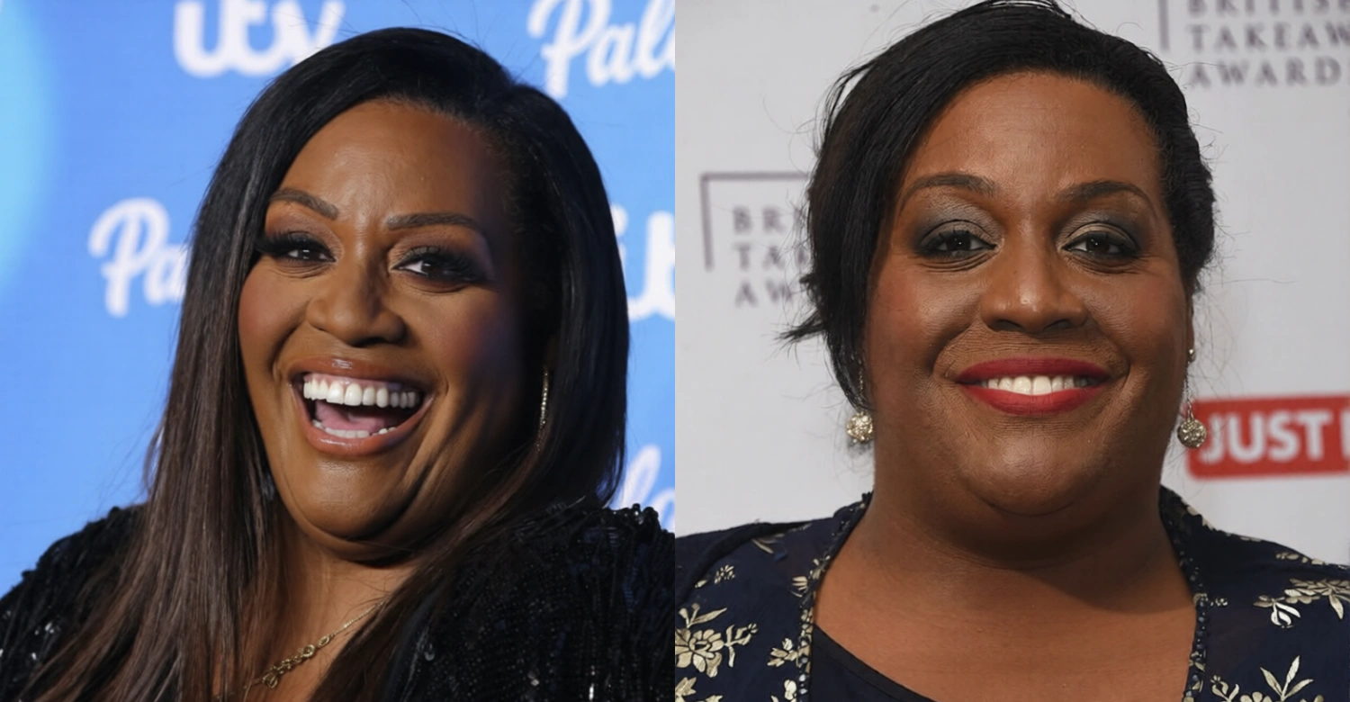 Alison Hammond Teeth1